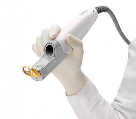 Cutera - Nd: YAG Laser Model Excel V