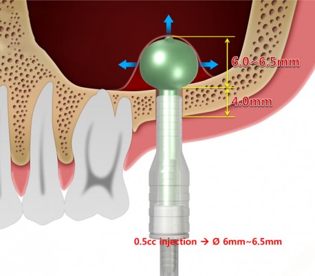 Dentium - Sinus Elevator