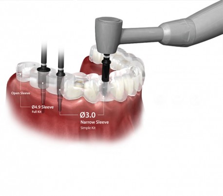 کیت کامل دیجیتال گاید - Dentium