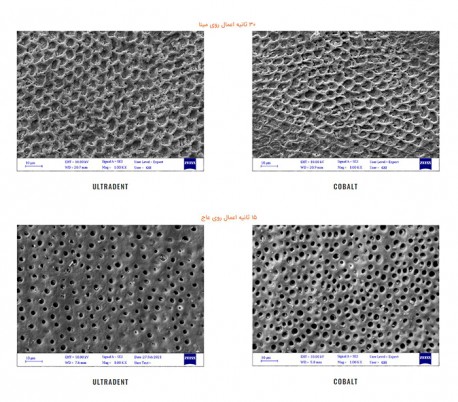 ژل اسید اچ 37% Cobalt Etch - کبالت بایومد