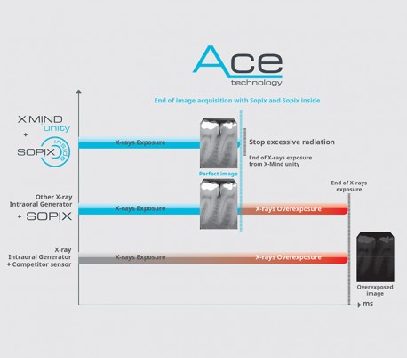 دستگاه رادیوگرافی XMind Unity DC مدل پایه دار - de Gotzen