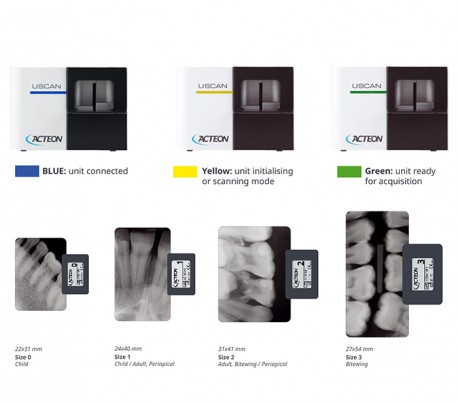 Acteon - U-Scan Phosphor Plate Scanner