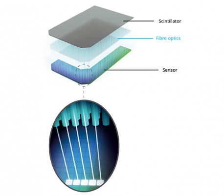 Acteon - U-Scan Phosphor Plate Scanner