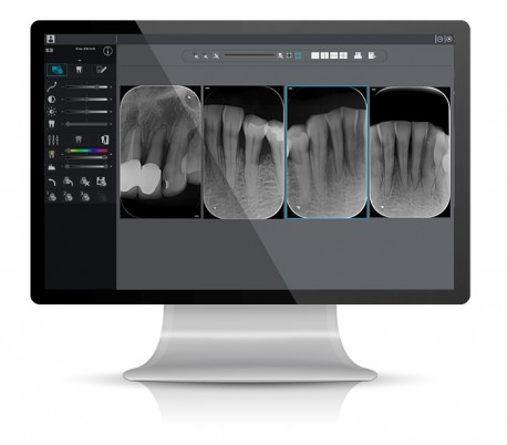 Acteon - U-Scan Phosphor Plate Scanner