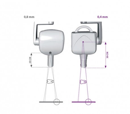 MyRay - RXDC Extend X-Ray Unit - Mobile