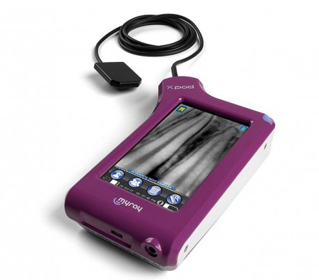 MyRay - X-Pod Portable Radiography Sensor