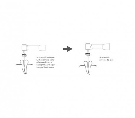 Bomedent - Marc III Endo Motor