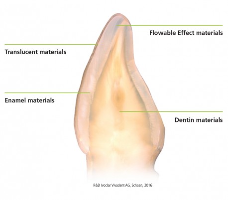 Ivoclar Vivadent - IPS Empress Direct Composite - Dentin