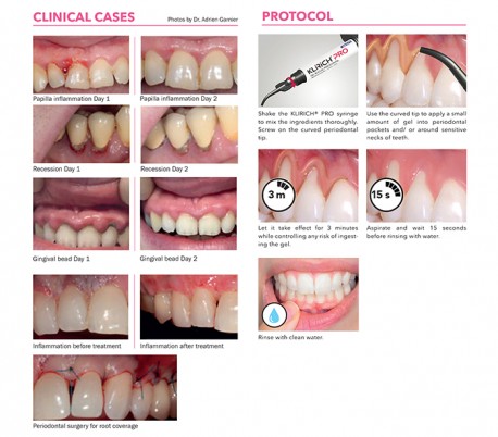 itena - KLiRiCH Pro Periodontal Gel