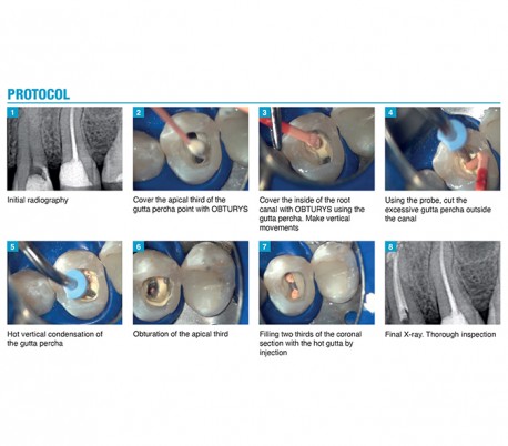 itena - Obturys Handmix Root Canal Sealer