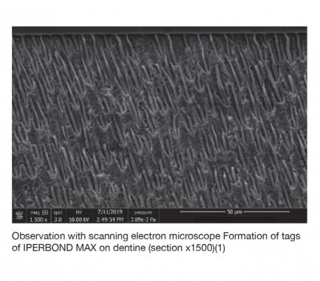 itena - Iperbond Max Universal Adhesive