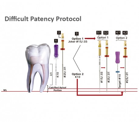 Bassi - Logic Glidepath Rotary File