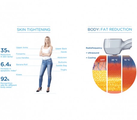 BTL Aesthetics - Exilis Ultra 360 Device