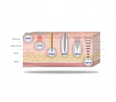 Jeisys - Ultracel  Hifu and RF Contouring Unit