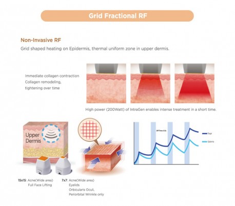 Jeisys - Ultracel  Hifu and RF Contouring Unit