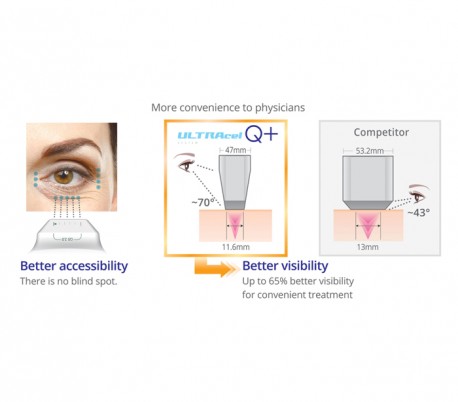 Jeisys - Ultracel Q Plus  Hifu Unit