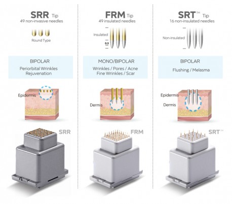 Jeisys - INTRAcel RF Fractional Microneedling Unit