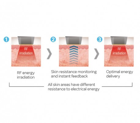 Jeisys - INTRAcel RF Fractional Microneedling Unit