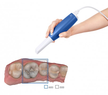 Medit - i600 Intraoral Scanner