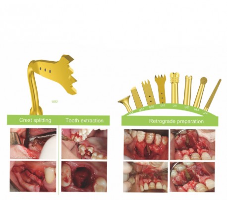 Woodpecker - Surgic Touch LED Piezo Bone Surgery