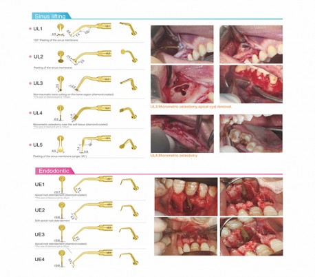 Woodpecker - Surgic Touch LED Piezo Bone Surgery