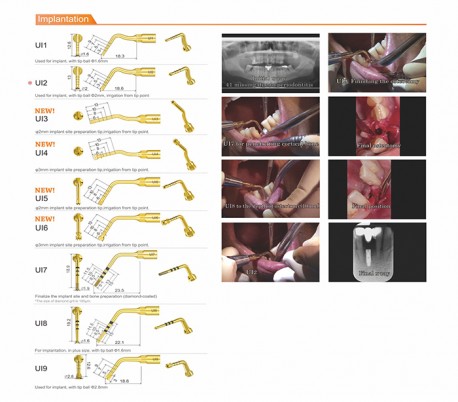 Woodpecker - Surgic Touch LED Piezo Bone Surgery