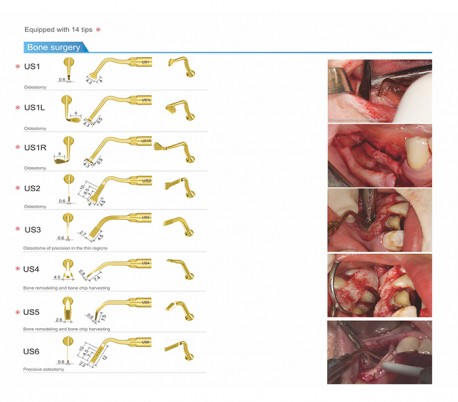 Woodpecker - Surgic Touch LED Piezo Bone Surgery