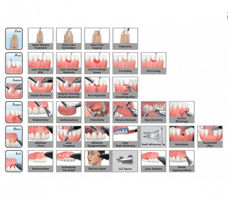 HuLaser - K2 Mobile Soft Tissue Dental Laser