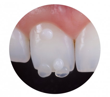 Biodinamica - epic Dentin Composite