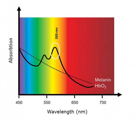 Advalight - Diode Laser Model ADVATx