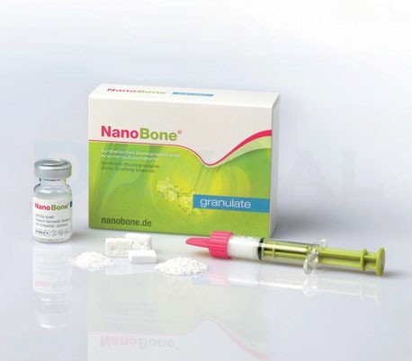 NanoBone Graft - Artoss