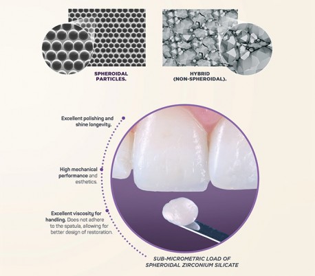 Materiale odontoiatrico in resina - Vittra APS - FGM Dental Products - in  composito / per ricostruzione dentale / per denti posteriori