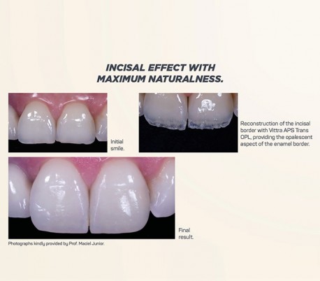 FGM - Vittra APS Enamel Composite 4gr