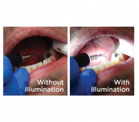 Parkell - TurboVue Ultrasonic Scaler