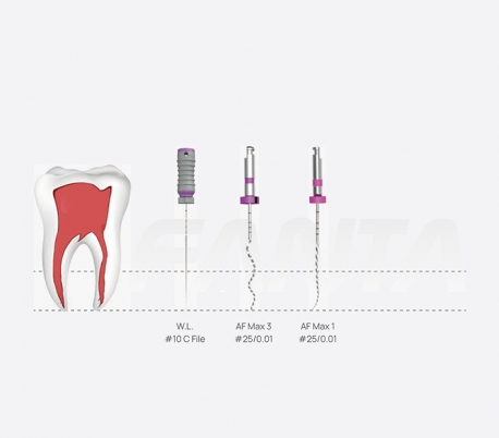 Fanta Dental - SP1 AF Max Rotary File