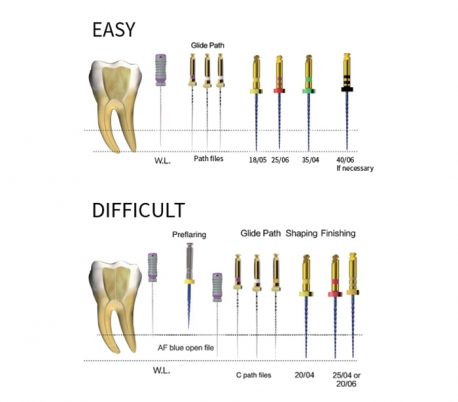 Fanta Dental - SP1 AF Blue Rotary File