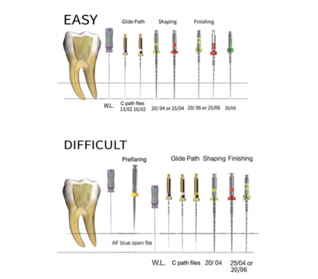 Fanta Dental - SP1 AF F One Rotary File