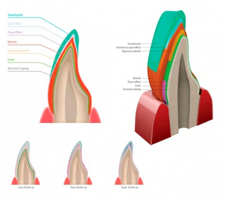 پودر پرسلن Genoss - rainbow Porcelain Opacious Dentin