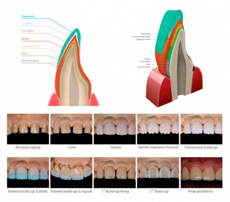 Genoss - rainbow Porcelain Opacious Dentin Powder