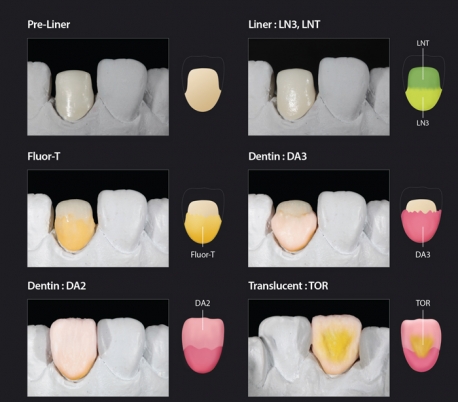 Genoss - rainbow Porcelain Opacious Dentin Powder