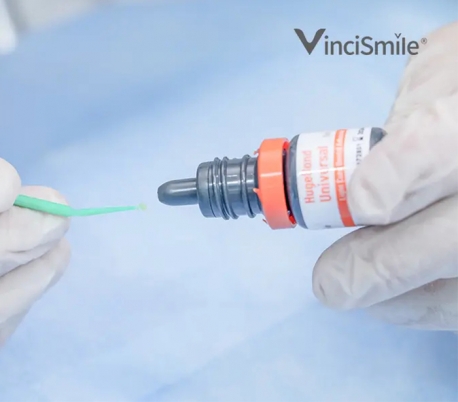 VinciSmile - HugeBond Universal Adhesive