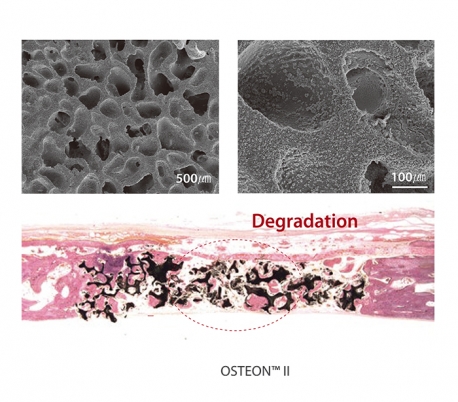 Genoss - OSTEON II Sinus Bone Graft Syringe