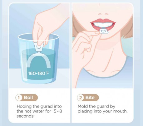 AV Dental - ThermoForm Bleaching Tray