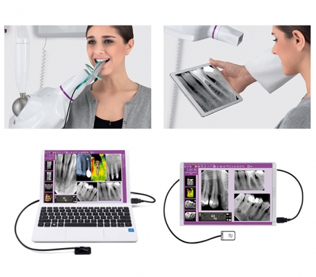 MyRay - Zen-X Radiography Sensor