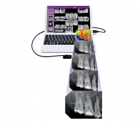 MyRay - Zen-X Radiography Sensor