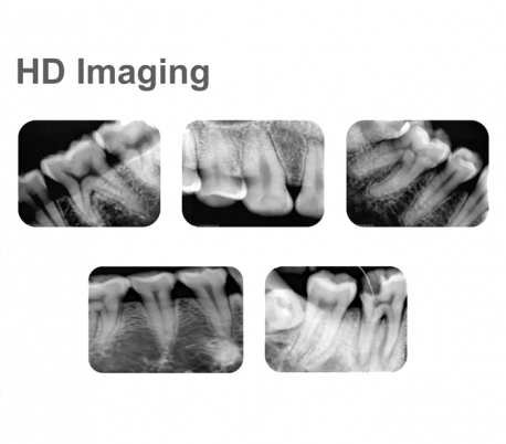 Runyes - DS530 Radiography Sensor