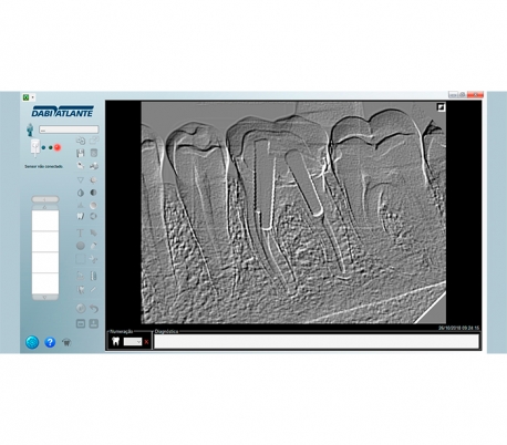 Dabi Atlante - New IDA Radiography Sensor