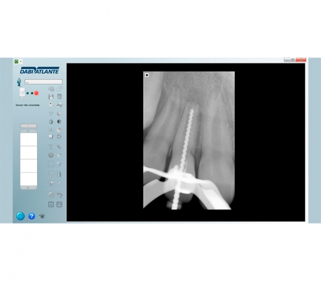 Dabi Atlante - New IDA Radiography Sensor