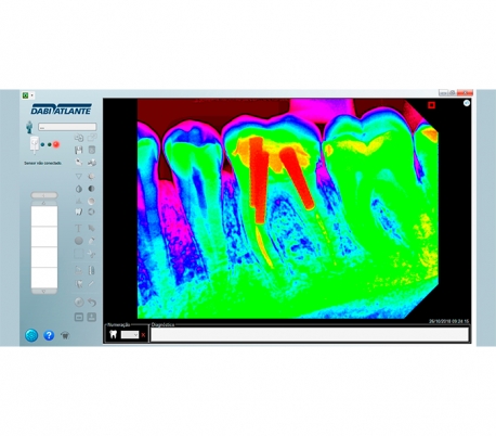 Dabi Atlante - New IDA Radiography Sensor