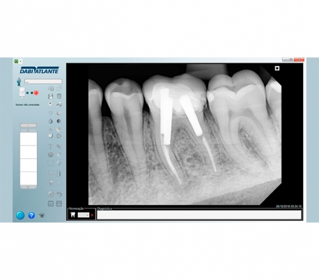 Dabi Atlante - New IDA Radiography Sensor